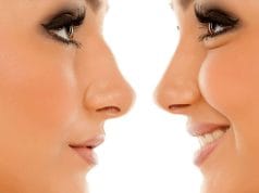 Quels sont les risques de la rhinoplastie ? intervention-esthetique-nez